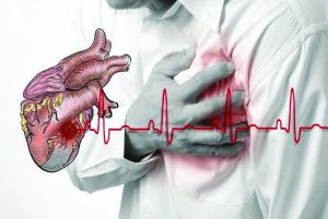 Studi Sebut Orang Bergaji Rendah Rentan Terkena Penyakit Jantung